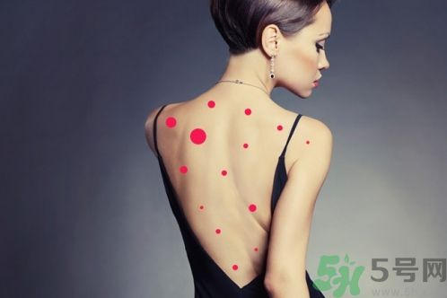 背上為什么會長痘痘？長痘痘怎么辦？