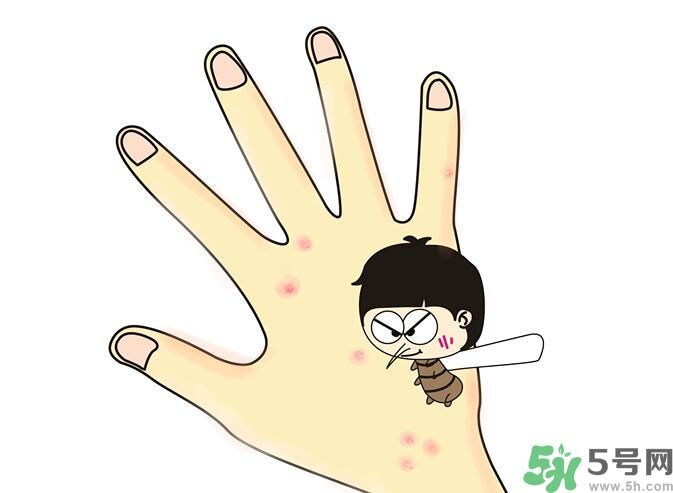蚊子叮的包過(guò)幾天又癢是為什么？蚊子叮的包過(guò)幾天又癢怎么辦？