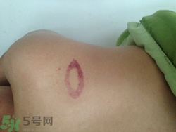 種草莓吻痕是什么意思？吻痕是怎么弄出來的？