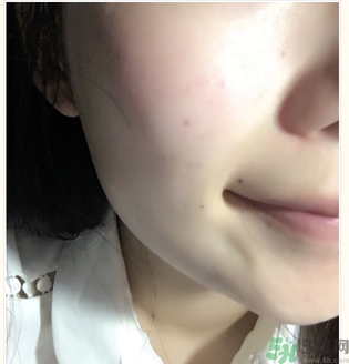 麗得姿面膜適合孕婦可以用嗎？麗得姿面膜哪些孕婦可以用？