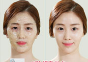 skin1004是什么牌子？skin1004屬于什么檔次