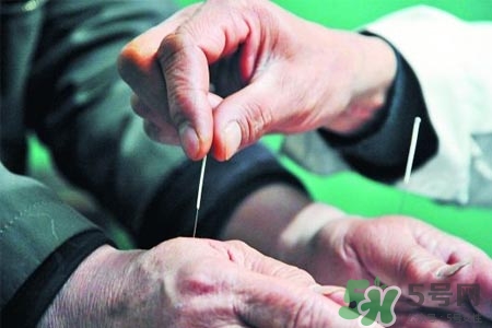 腰間盤突出可以針灸嗎？針灸能治腰間盤突出嗎？