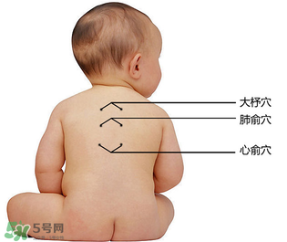 三九貼能治什么病？三九貼的作用