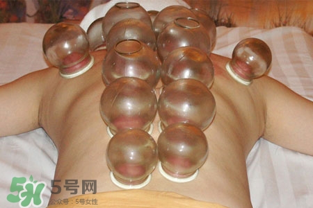 冬天可以拔罐放血嗎？冬天拔罐放血好嗎？