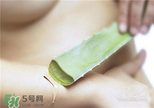 蘆薈涂在臉上發癢是怎么回事？蘆薈涂在臉上發癢怎么辦？