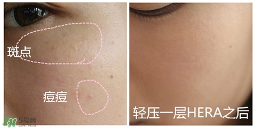 赫拉氣墊用了悶痘嗎？赫拉氣墊悶痘怎么辦？