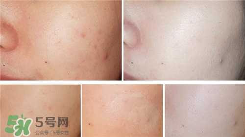 稚優泉氣墊bb霜色號 稚優泉氣墊bb霜試色