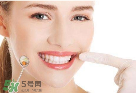 如何去掉牙結石？牙結石怎么去除