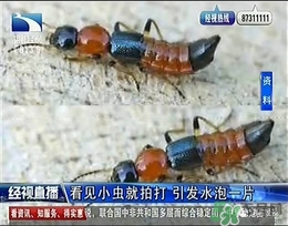 隱翅蟲有毒嗎？隱翅蟲會毀容嗎？