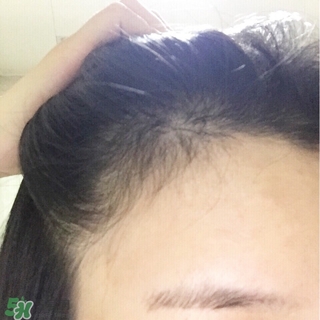 aveda生發噴霧怎么用?aveda生發噴霧使用方法