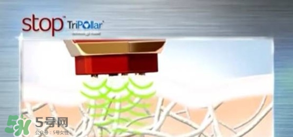 tripollar stop怎么樣？tripollar pose好用嗎