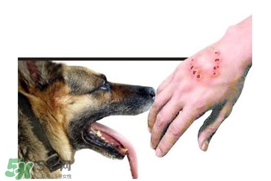 狂犬病會傳染嗎？狂犬病會學(xué)狗叫嗎