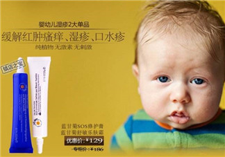恩姆花園濕疹膏有激素嗎？恩姆花園濕疹膏含不含激素？