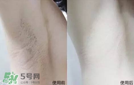 nair脫毛膏評測？nair脫毛膏保質期