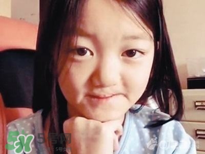兔唇是什么？兔唇是什么原因造成的？