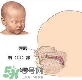 兔唇能檢查出來嗎？兔唇能完全修復嗎？