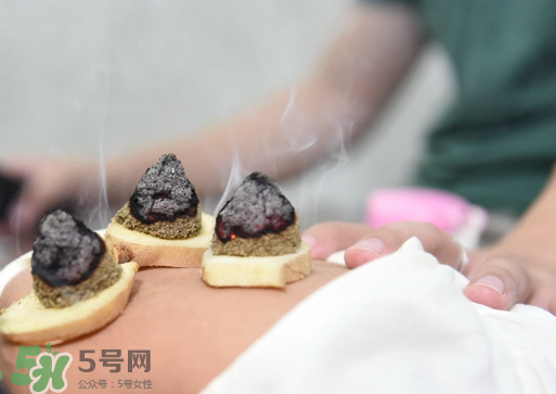三伏灸什么人不能做？三伏灸適合哪些人？