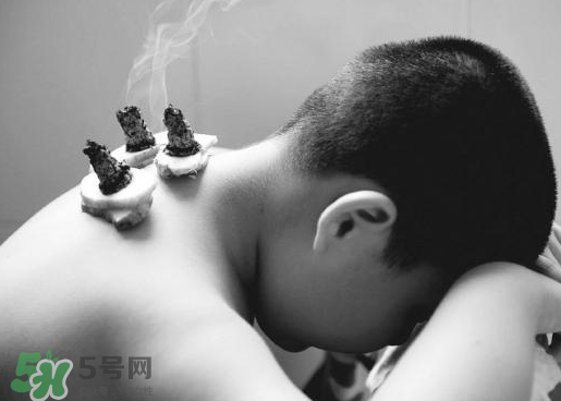 三伏灸什么人不能做？三伏灸適合哪些人？