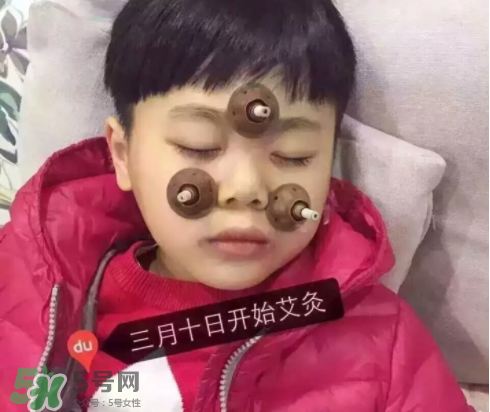 艾灸貼可以治咳嗽嗎？艾灸貼可以治退燒嗎？