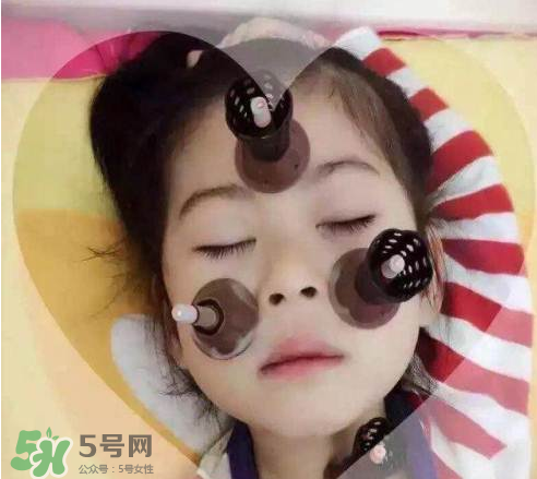 艾灸貼可以治咳嗽嗎？艾灸貼可以治退燒嗎？