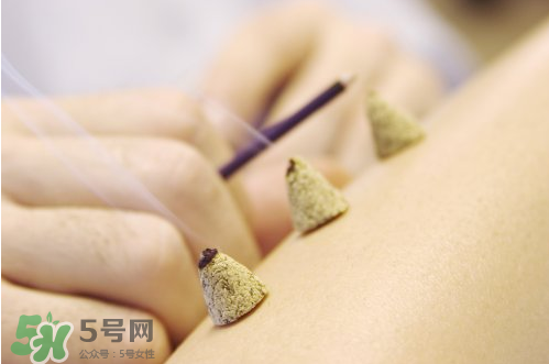?三伏灸和艾灸的區別_三伏灸是艾灸嗎