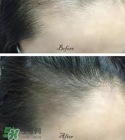 發際線粉要卸妝嗎_怎么卸？