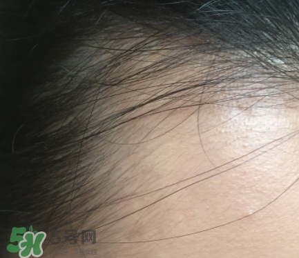 發際線粉要卸妝嗎_怎么卸？