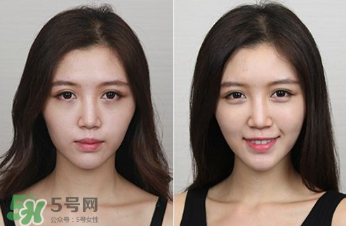 蘋果肌怎么化？蘋果肌究竟哪里好？