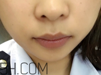 小蜜蜂細(xì)致修護(hù)唇膏很油嗎？夏天用合適嗎？