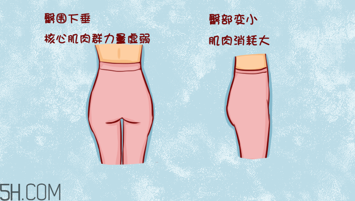 臀部護(hù)理對健康有什么影響？日常如何保養(yǎng)臀部健康？