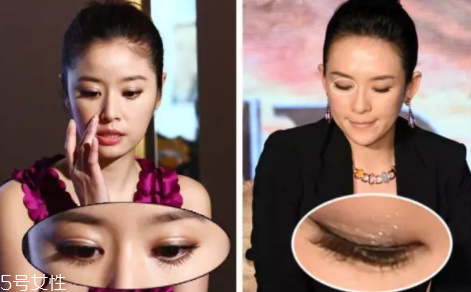內雙怎么進化成雙眼皮？全是雙眼皮貼的功勞