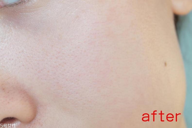 radha beauty vc精華白天能用嗎？敏感肌能用嗎？