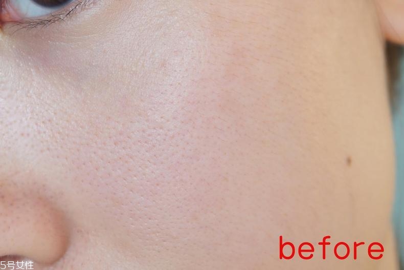 radha beauty vc精華白天能用嗎？敏感肌能用嗎？