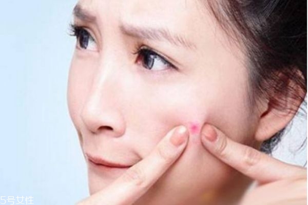 女生臉上長痘怎么調理 女生臉上長痘吃什么水果好