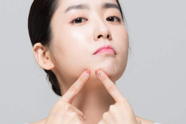 女性下巴長痘的原因有什么 為什么女性下巴會(huì)長痘