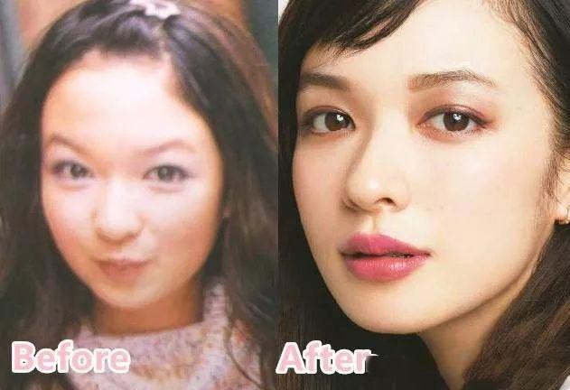 日式整容和韓式整容有什么區別 極致美與自然美