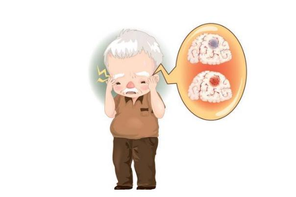 中風的癥狀與急救措施 中風的人吃什么好