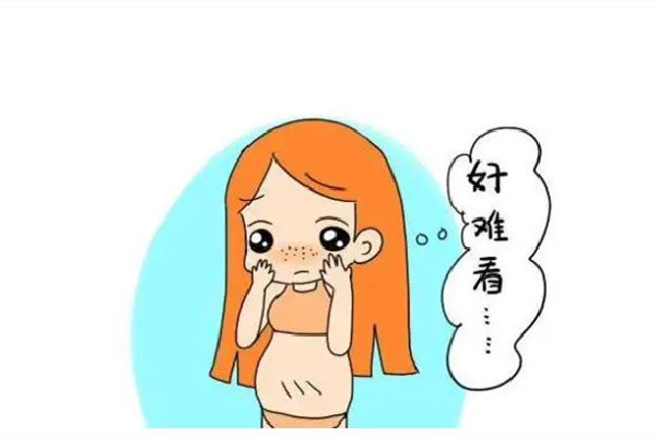 妊娠紋初期可以消掉嗎 妊娠紋初期怎么控制繼續擴張