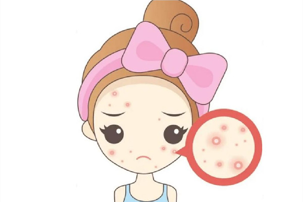 后湖SOR索爾祛痘?面部肌膚科學管理痘肌清潔做的怎么樣 痘肌怎么清潔皮膚