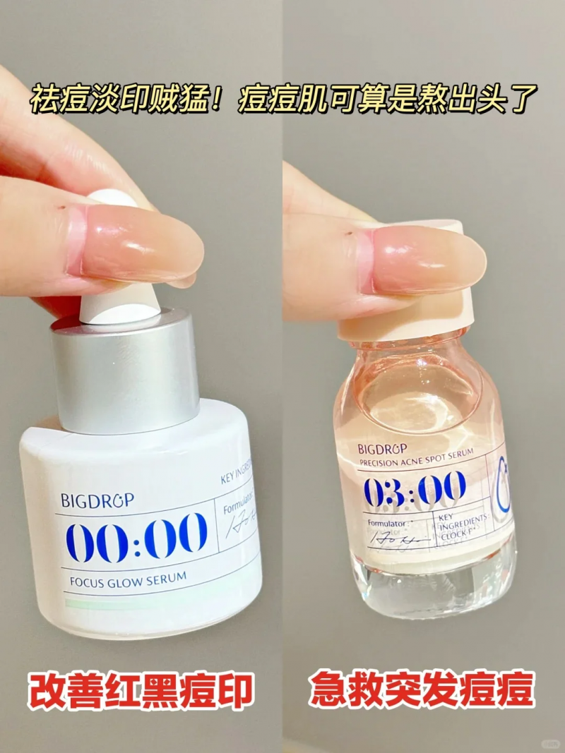 祛痘產(chǎn)品橫測(cè)：谷雨白千祛痘凝膠、大水滴與達(dá)爾膚杏仁酸，誰是祛痘王者？